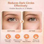 EMS Red Light Eye Massager | Dark Circle Remover & Eye Fatigue Relief Device