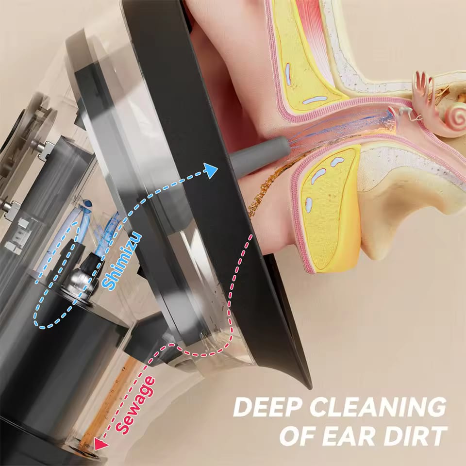 Electric Ear Wax Removal System – Water Powered Ear Cleaning Tool with 3 Pressure Settings